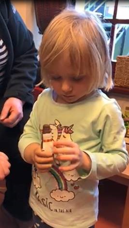 Dysmelieversorgung – auch bei den Kleinsten möglich!