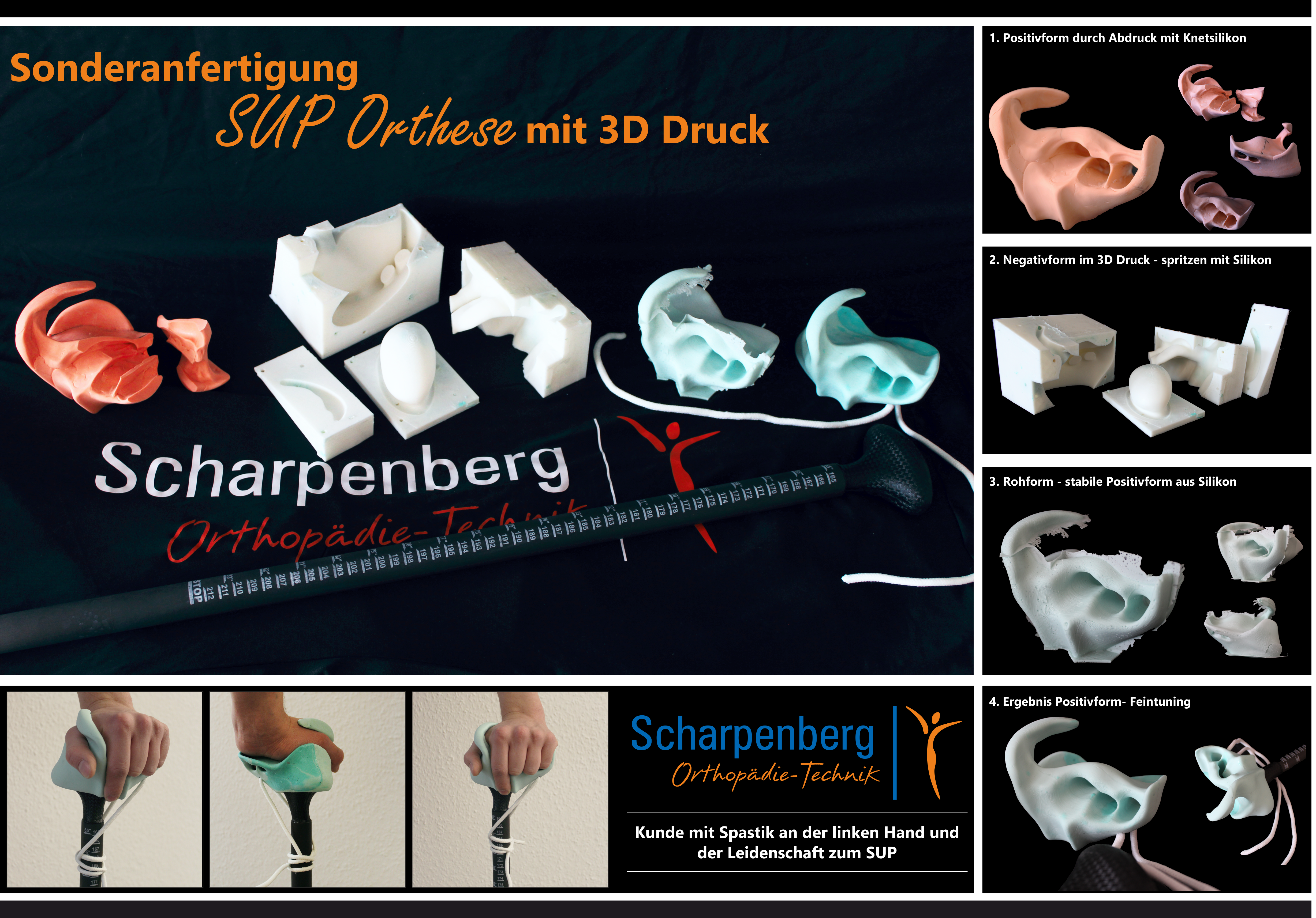 SUP Orthese im 3D-Druck – Sonderbau