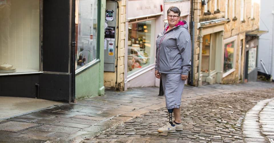 Neue Entscheidung: Krankenkasse muss Badeprothese auch mit beweglichem Fuß bezahlen