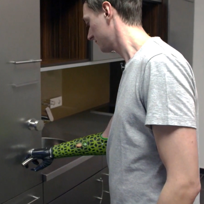 Intelligente Prothese