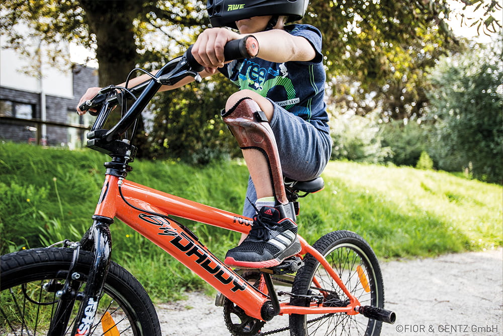 Ein junge fährt seinem BMX Rad und trägt dabei eine Beinorthese.