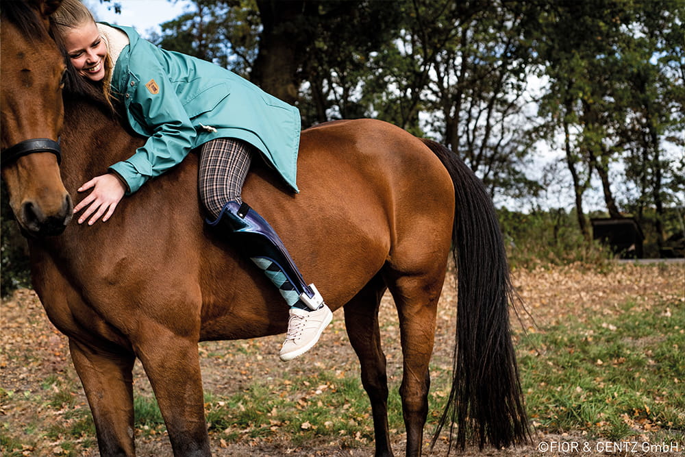 Eine Frau mit Beinorthese sitzt auf einem Pferd.