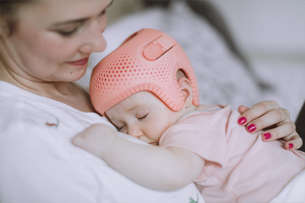 Eine Frau hat ihr Baby auf der Brust. Das Baby trägt eine Kopforthese von Talee.