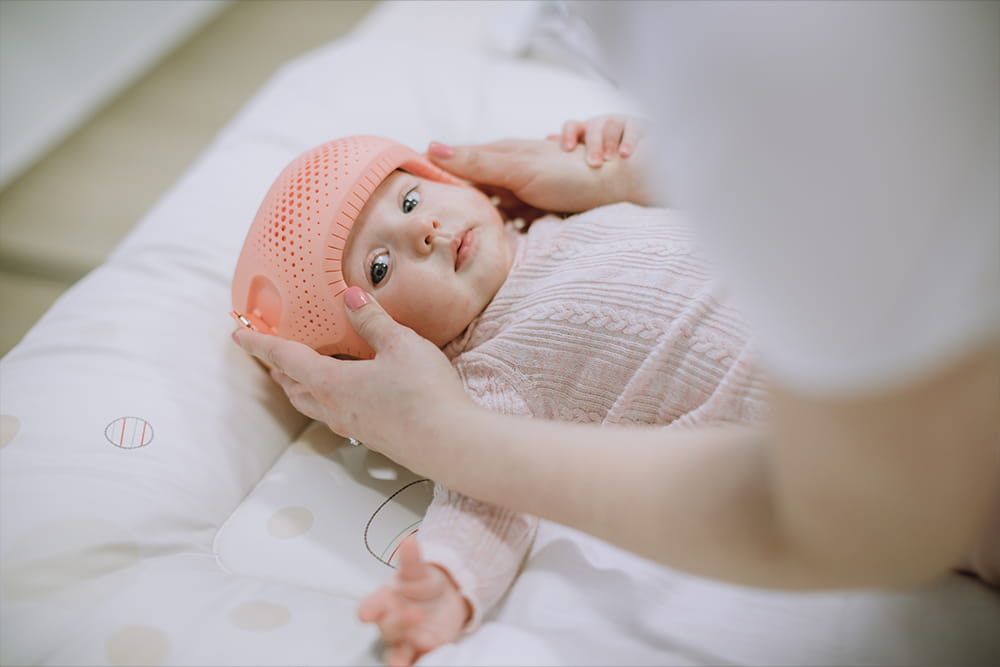 Einem Baby, das auf dem Rücken liegt, wird gerade eine Kopforthese angelegt.