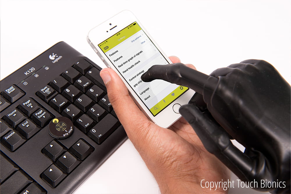 Ein Mann mit Bionischer Hand bedient ein Smartphone.
