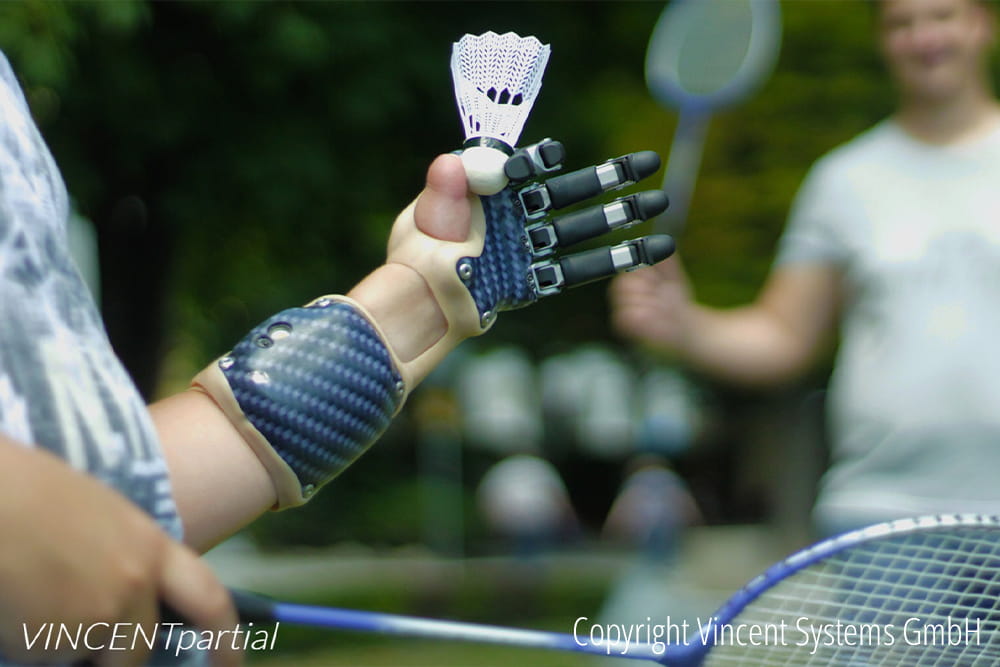 Eine Person mit Bionischer Hand spielt Tennis.