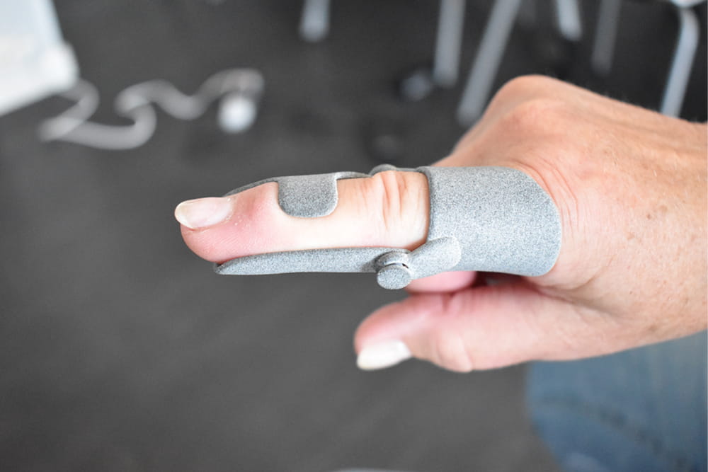 Eine 3D gedruckte Fingerorthese in grau.