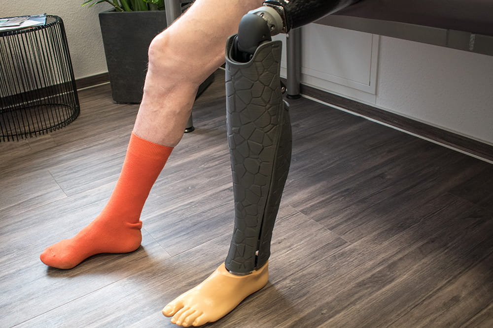 Ein Mann mit Oberschenkelprothese und einem Prothesencover nach Maß sitzt auf einer Bank im Sanitätshaus.